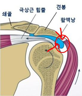 Shoulder Impingement Syndrome 1: How is your shoulder doing? — 본문 그림