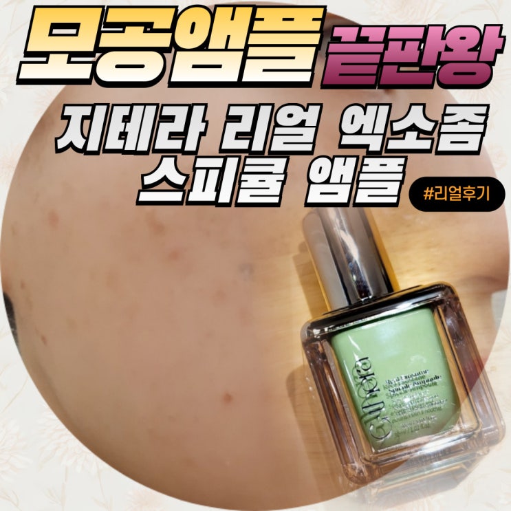  모공축소앰플 추천 지테라 리얼 엑소좀 스피큘앰플 여드름 흔적도 삭제