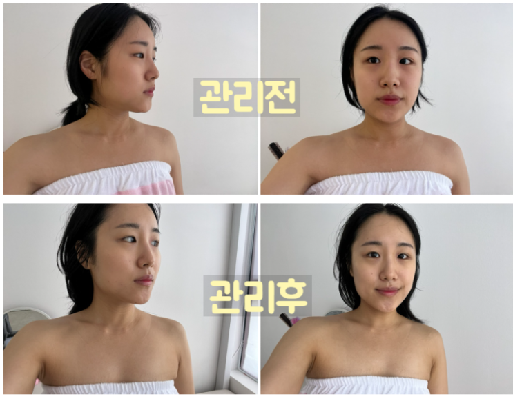 신도림 피부관리 윤곽관리 브이라인 루시엘라뷰티