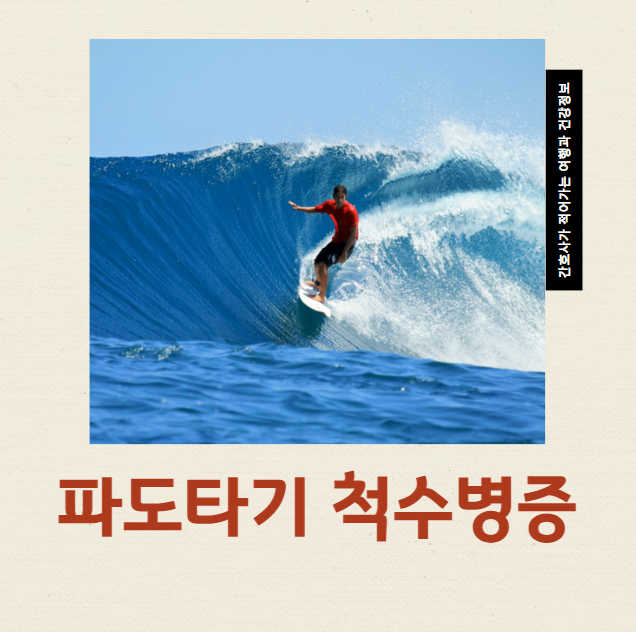  서핑 하반신마비의 위험 '파도타기 척수병증'