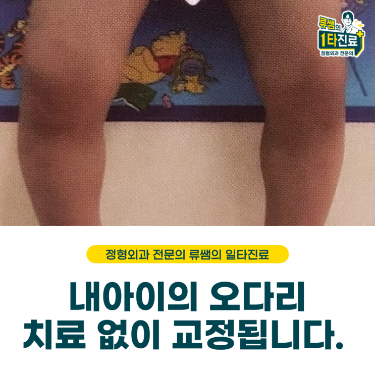  내 아이의 오다리 교정해야할까요?(정형외과 의사 작성)