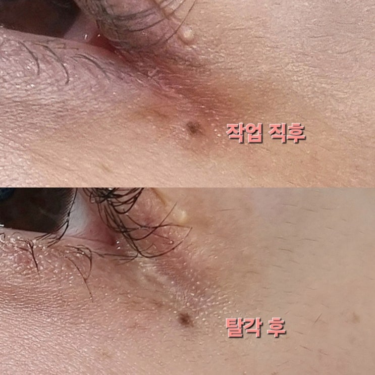  광주 미인점 진정한 완성은 탈각 후죠 유스뷰티