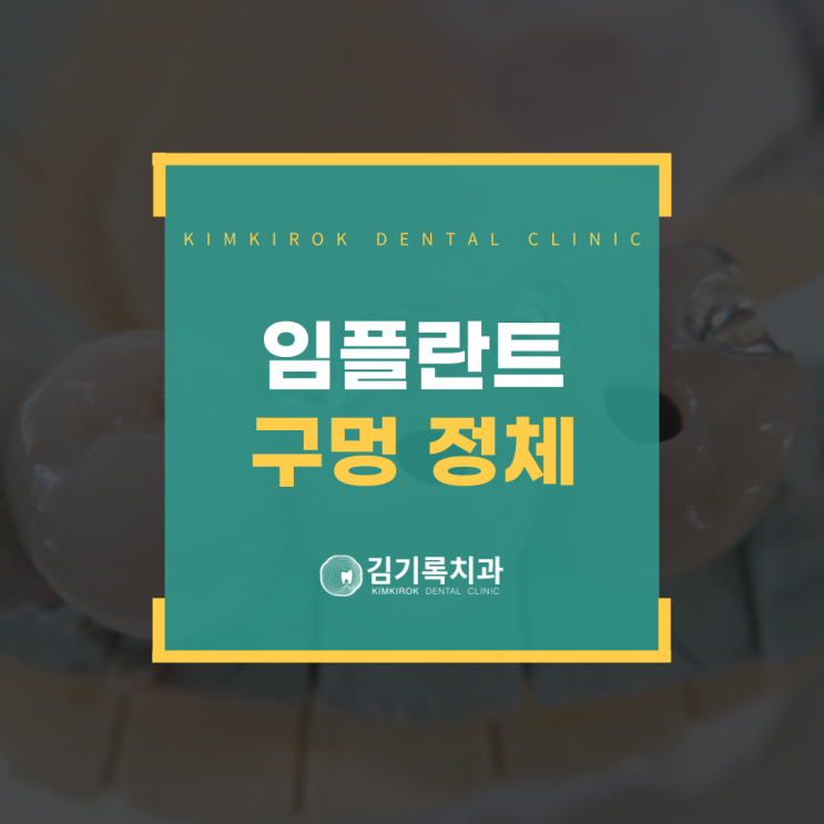 권선1동치과 임플란트 구멍, 충치인가요? 홀의 정체