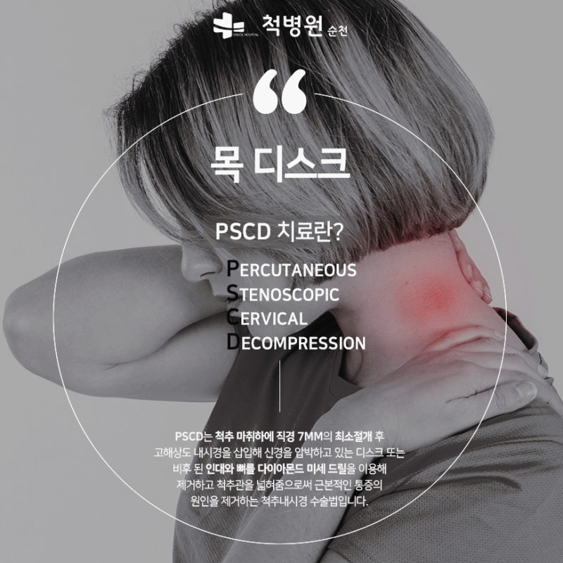 순천목디스크 수술 : 내시경을 이용해 보다 정교하고 안전하게..