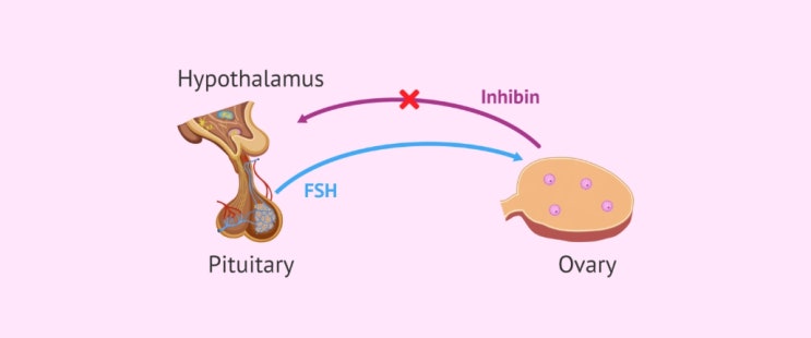  Inhibin 인히빈 검사 Inhibin-A Inhibin B