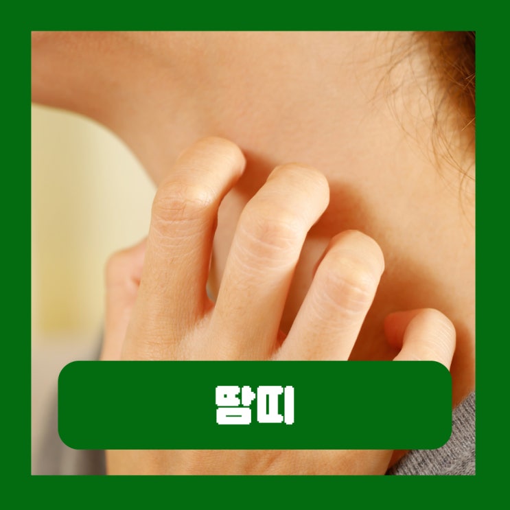  성인 땀띠 연고 겨드랑이 사타구니 가려움 증상 치료 예방