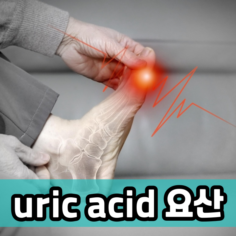 uric acid 요산 혈액 검사 남자 여자 정상 수치 관리 방법