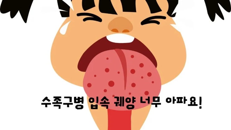  수족구병 손발 발진 입병 증상 치료 예방법