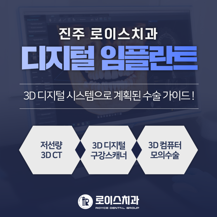  진주시인근치과 "임플란트 수술 치과 선택 전 확인해야 할 사항"