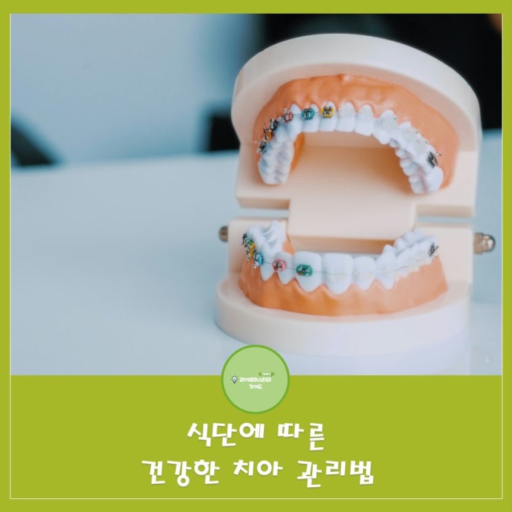  식단에 맞춘 건강한 치아 관리법