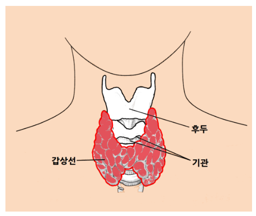  갑상선 기능 항진증의 증상, 원인, 치료(메티마졸, 안티로이드 부작용)