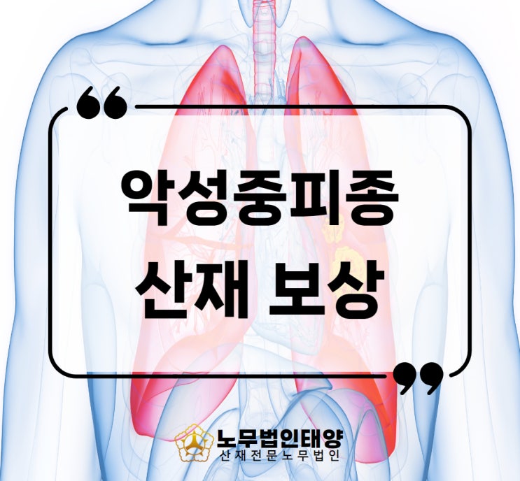  악성중피종 산재 원인 항암치료 석면피해구제