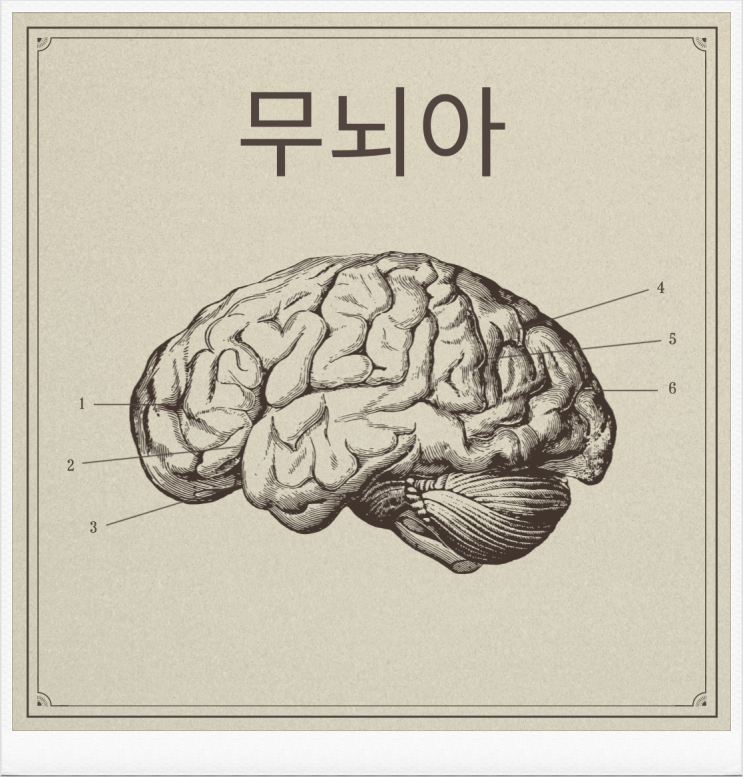  무뇌아 아기 울음소리 출산 후 생존율부터 예방법까지 알아보자