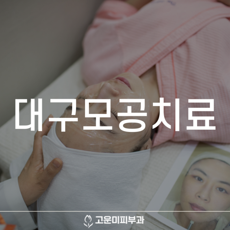  대구모공치료 여름이 되면 더 넓어지는 모공 원인에 맞는 맞춤 시술