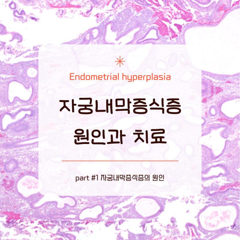 자궁내막증식증은 왜 생길까? _ unopposed estrogen의 원인들