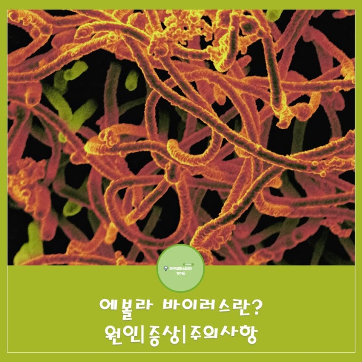 에볼라 바이러스란? 원인|증상|주의사항 알아보기