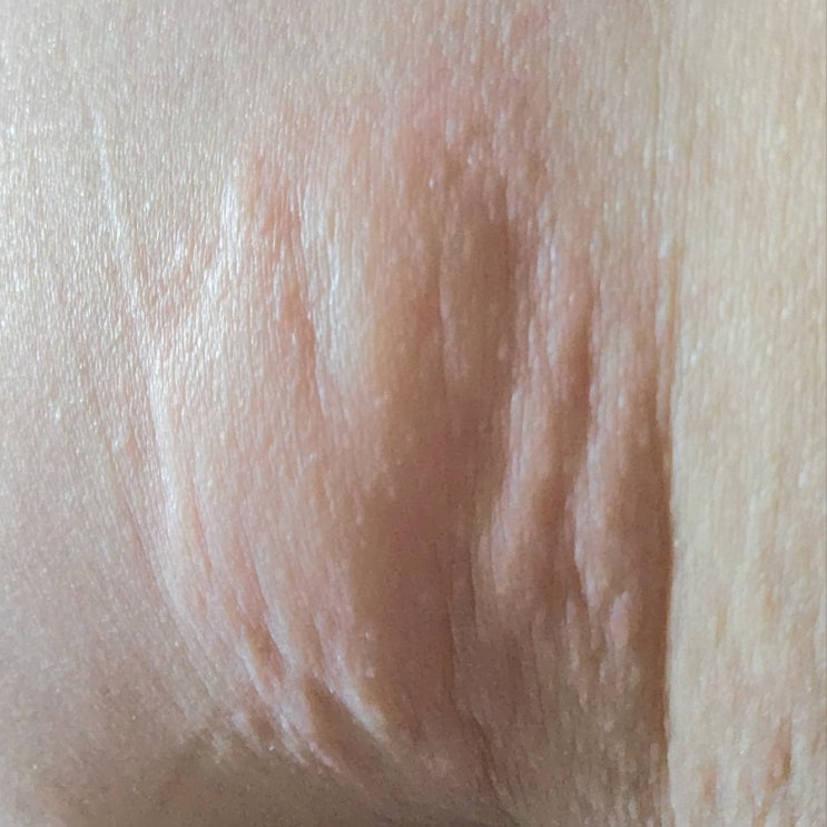  홍대 합정 피부과 닥터포유의원