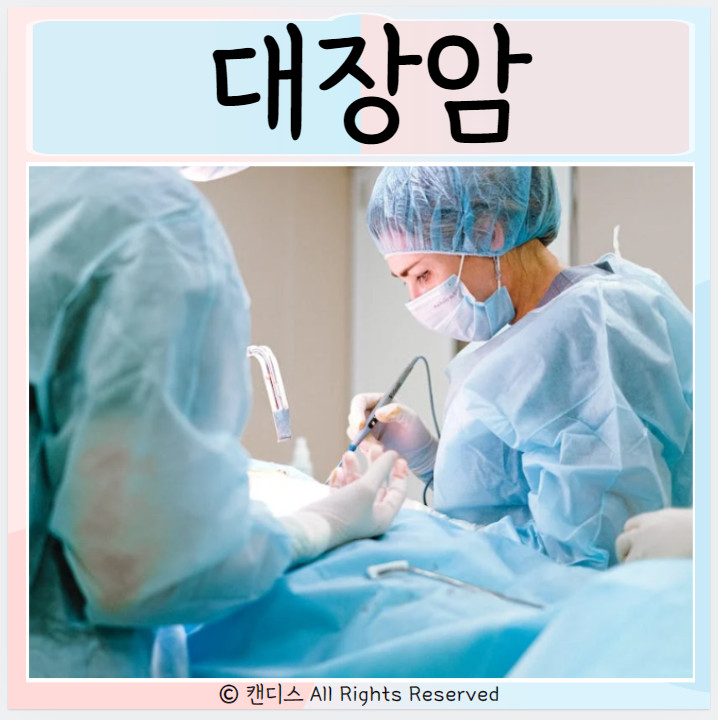  대장점막내암 대장암 원인 치료 증상