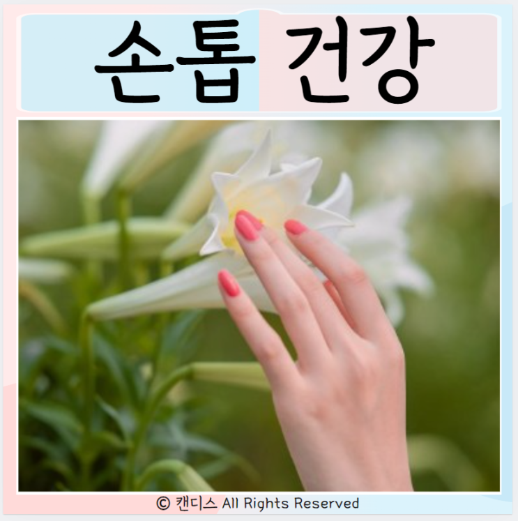  손톱건강 흰 반점 녹색, 세로줄 관리