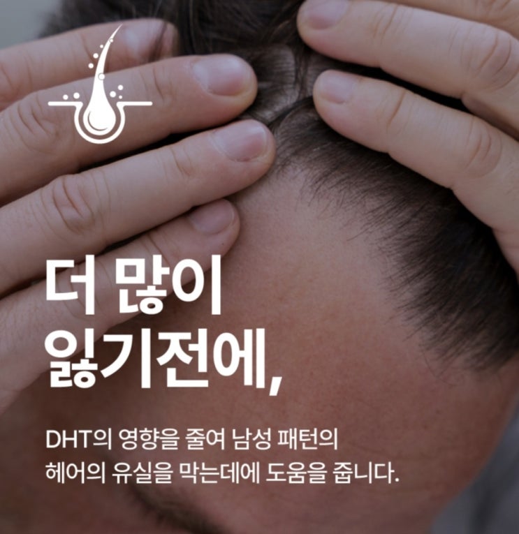  탈모 영양제, 먹어도 효과가 하나도 없었던 이유 공개