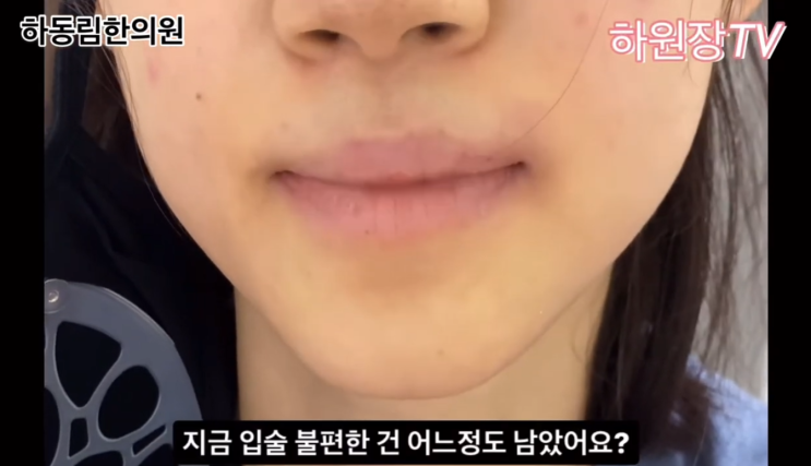  입술 습진, 수포, 구순염의 원인과 근본적 치료법 +치료사례