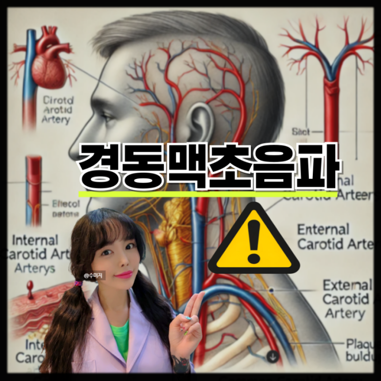  목 초음파, 경동맥 초음파 검사 경동맥협착증 (동맥경화 증상 치료)