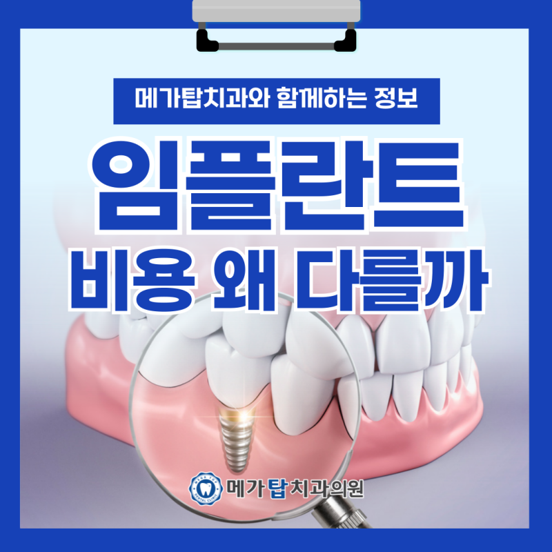 안양 임플란트 수술 전 고려사항