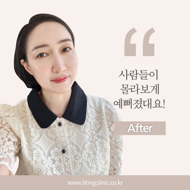  [비포애프터] 고객님의 애프터 사진을 공개합니다!