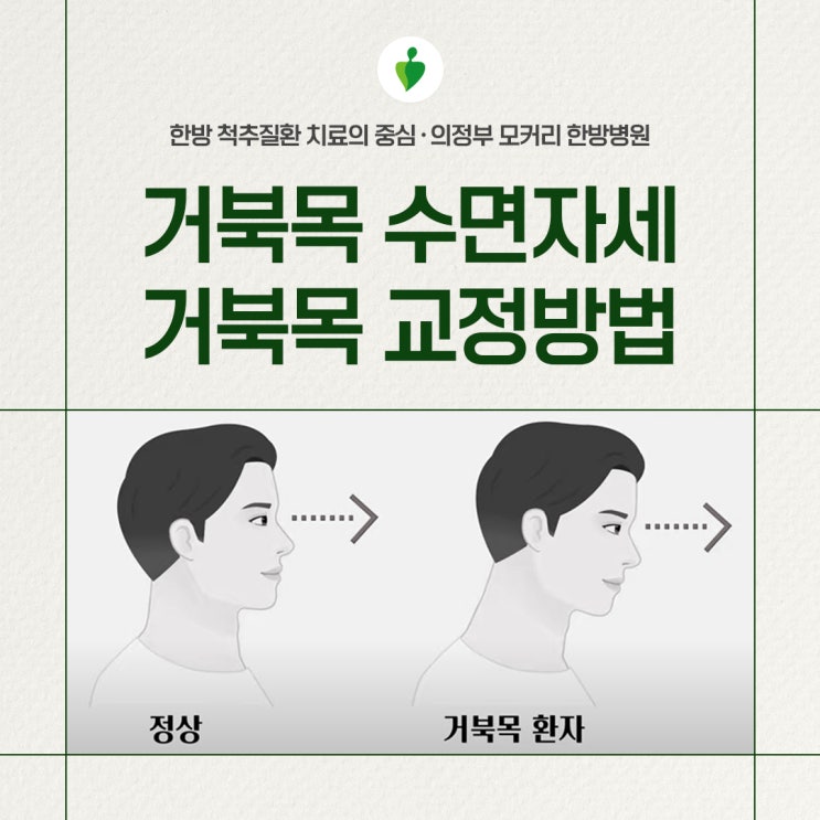  가능동한방병원 거북목 자세로 자면 안 되는 이유, 거북목 교정 방법
