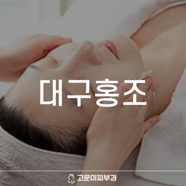  대구홍조 수시로 얼굴이 화끈거리고 붉어지는 홍조의 원인과 치료