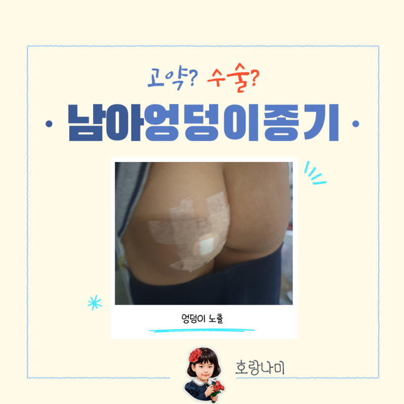 아이 엉덩이종기고약 사용후기