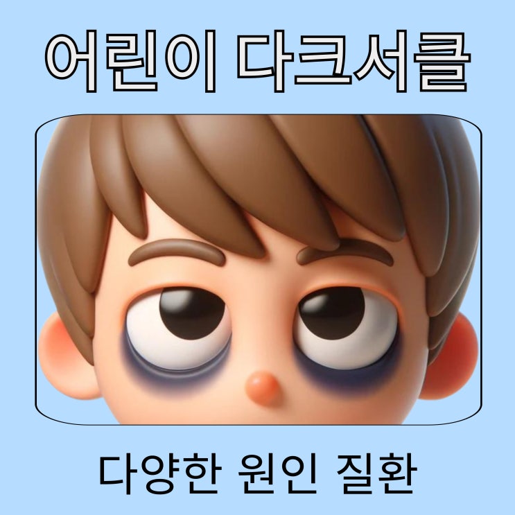  어린이 다크서클 치료, 우리 아이 알레르기 비염. 불면증도 원인이 되나요?