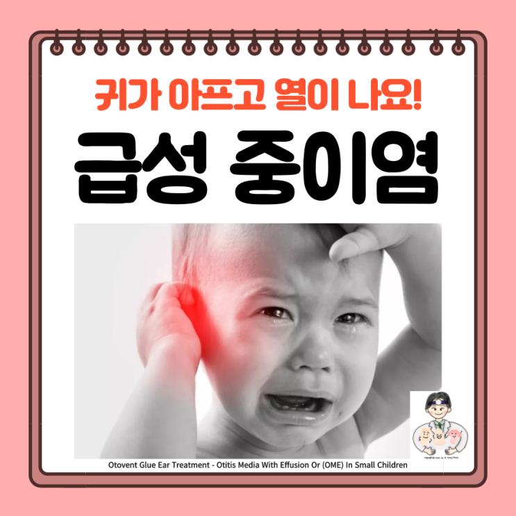  아기 성인 급성 중이염, 원인 단계 증상 통증 치료