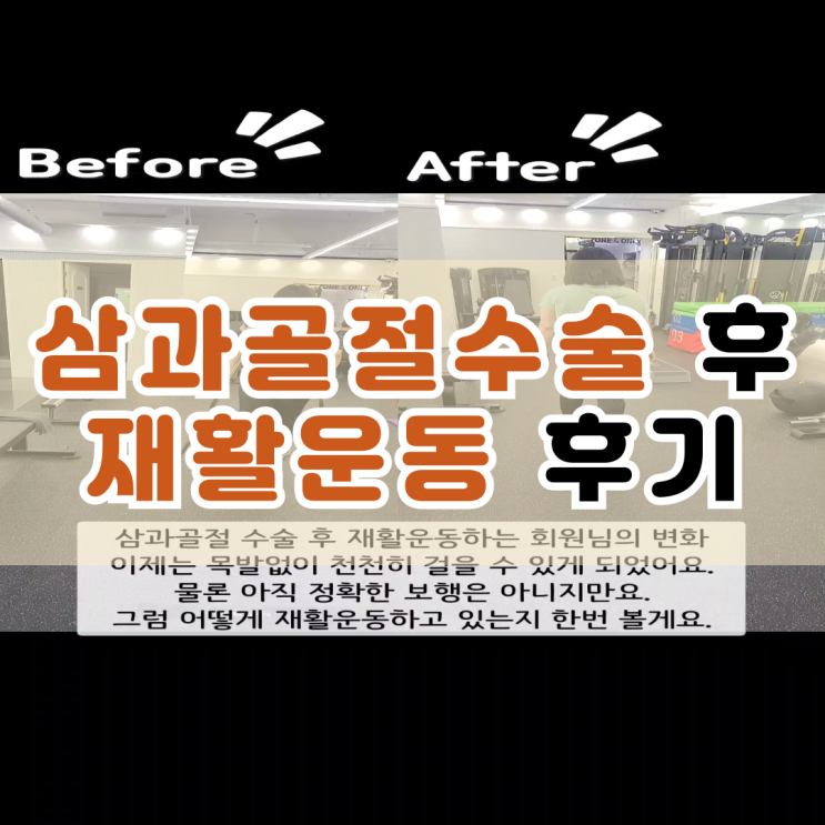  부산재활PT 발목 삼과골절 수술 후 재활운동 후기