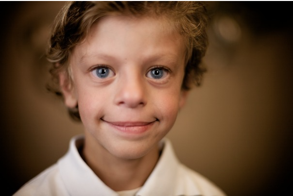 꿈이든치료사)윌리엄스증후군(Williams Syndrome)에 대해서 알아보자.
