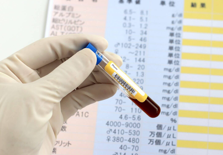  CTC검사는 암재발과 전이 위험을 조기 발견할 수 있습니다.