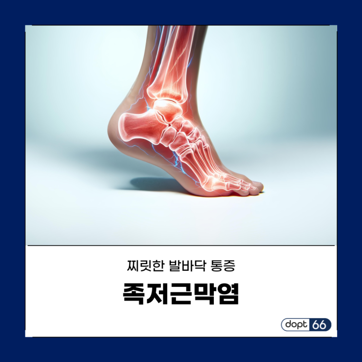  족저근막염 원인·증상 및 치료 방법