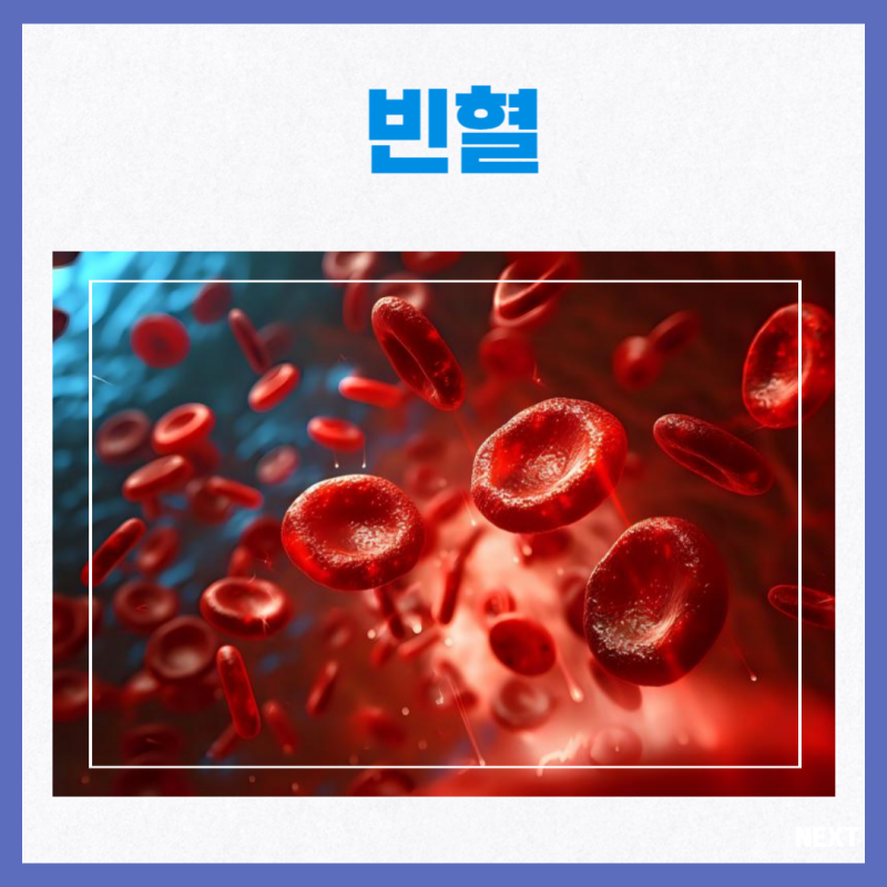 악성 빈혈 증상 원인 빈혈에 좋은 음식 : 네이버 블로그