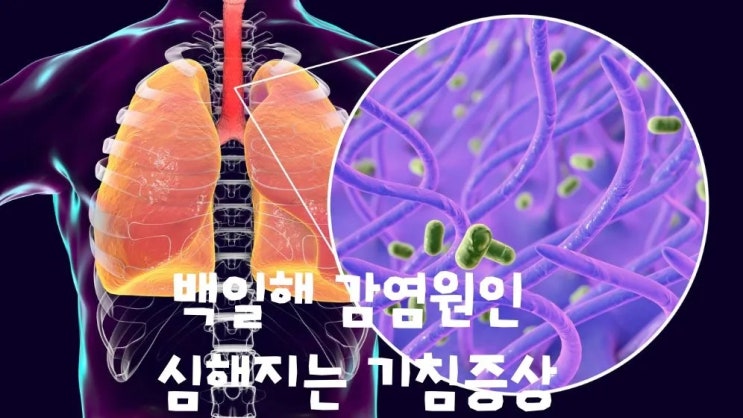  백일해 감염원인 기침증상 감염통로 예방법