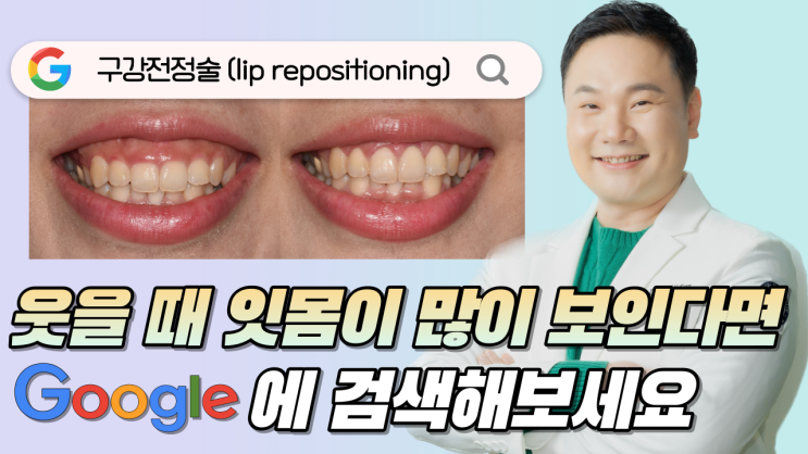  웃을 때 잇몸, 구강전정술 정확한 정보 얻는 방법