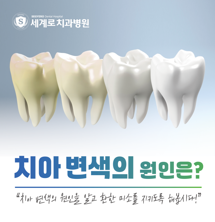  치아 변색 원인과 하얀 이를 지키는 법