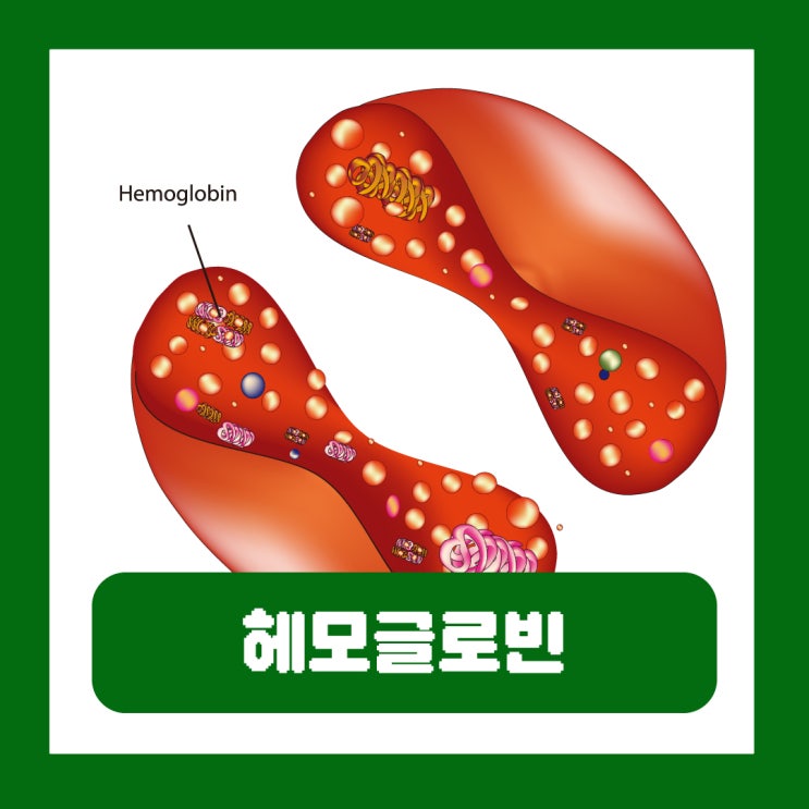  헤모글로빈 정상수치 적혈구 수치 낮음 증상 이유 빈혈에 좋은 음식