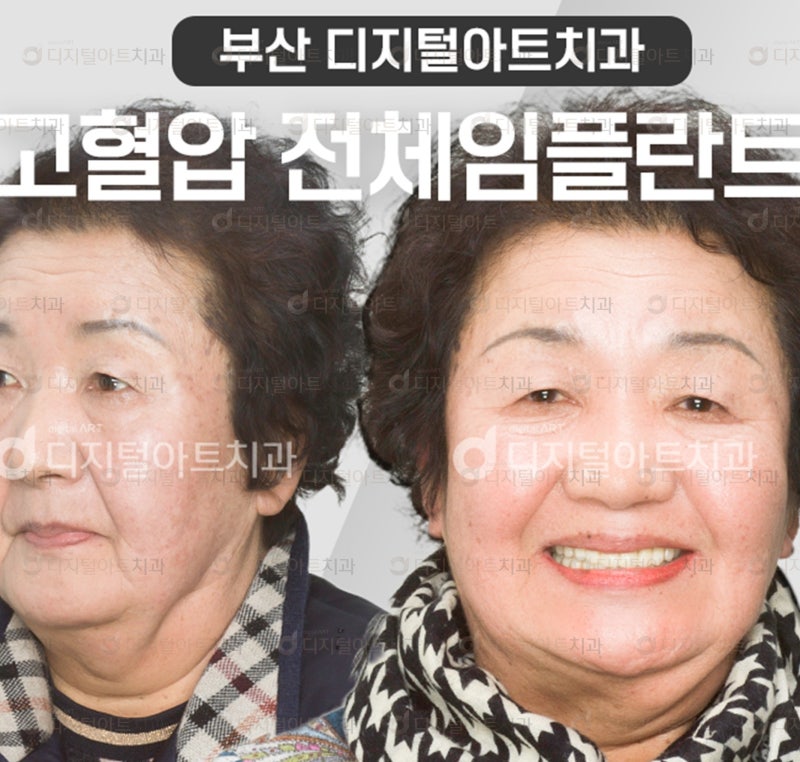 강서구치과의원과의 차이점을 볼 수 있는 곳