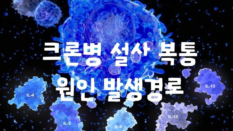  크론병 설사 복통 원인 증상 치료 관리법