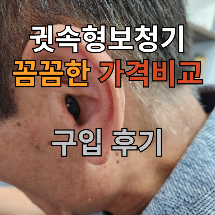  귓속형보청기 가격 꼼꼼하게 비교하고 구입한 후기
