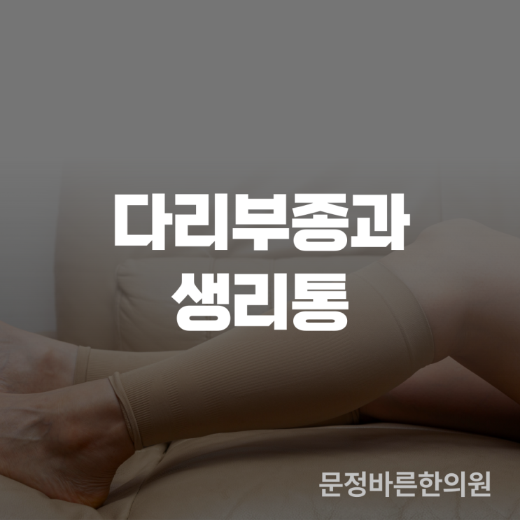 다리부종과 생리통이 있는 환자 치료 예 다리부종과 생리통이 있는 환자 치료 예