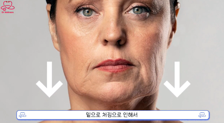  리프팅 전문 반포동 피부과 대표원장이 말하는 블루로즈 실리프팅과 그 밖에 실리프팅 특징