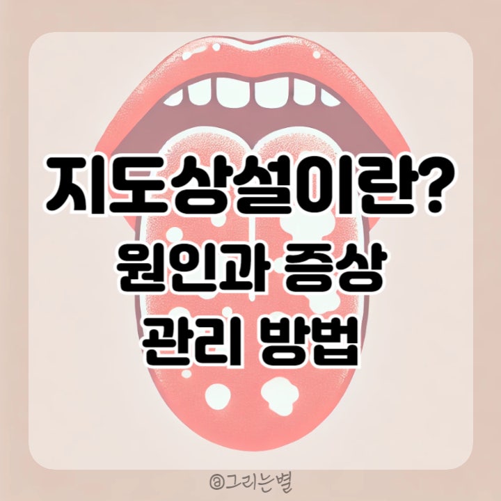  지도상설이란? 지도 모양 혀의 원인과 증상, 효과적인 관리 방법 알아보기