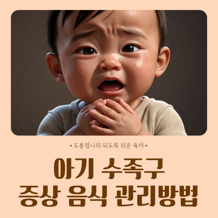  아기 수족구 증상 고열 수포 얼마나 잘 먹는 음식 관리방법