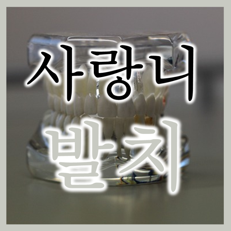  사랑니 발치 반드시 필요한 경우와 주의사항
